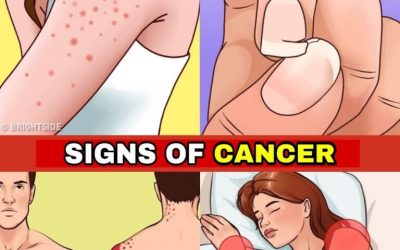 12 Early Warning Signs Your Body May Be Developing Cancer Cells