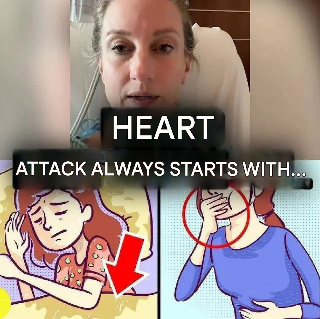 Heart attack at 46: “I didn’t recognize the symptoms that appeared a week earlier…(1 / 2)