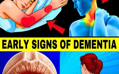 10 Early Signs of Dementia You Should NEVER Ignore!