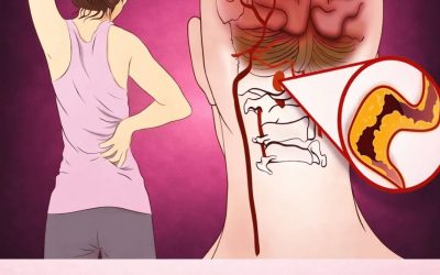 10 Early Warning Signs of a Stroke Everyone Should Know to Take Prompt Action
