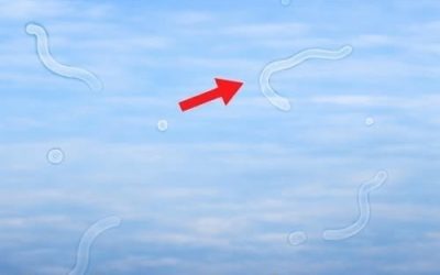 What to Do If You Start Seeing Eye Floaters: An Eye Doctor’s Helpful Guide