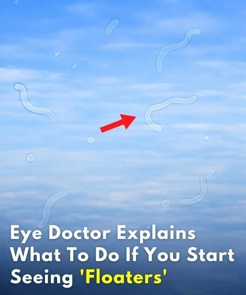 What to Do If You Start Seeing Eye Floaters: An Eye Doctor’s Helpful Guide