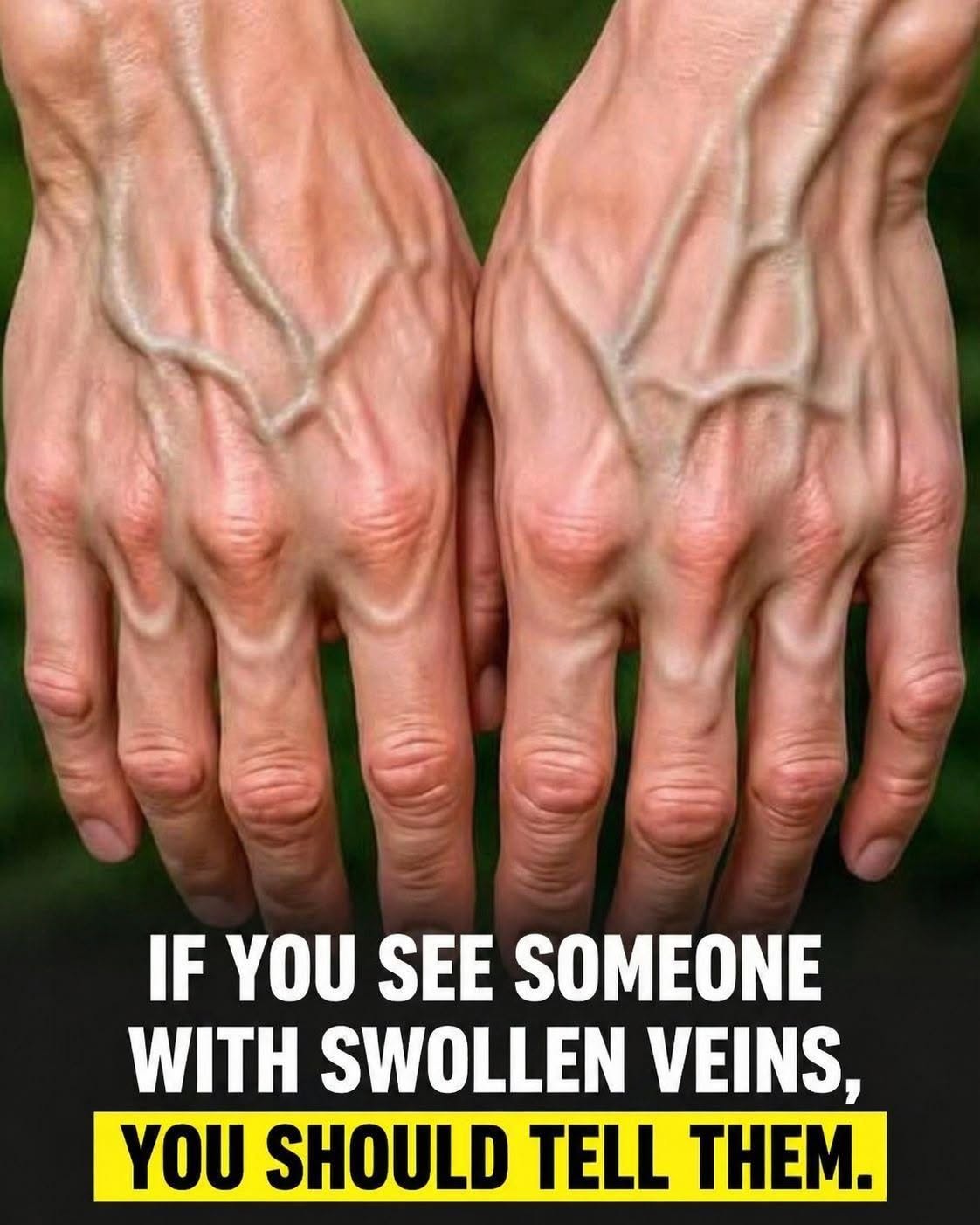 If your veins are visible, it means you are… See more