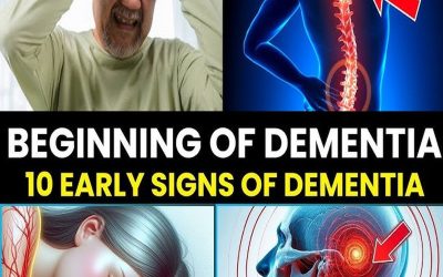 7 EARLY SIGNS of ALZHEIMER’S DISEASE that you SHOULD