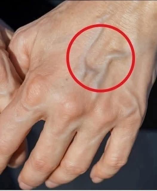 Natural Remedies to Improve the Health of Your Veins and Skin