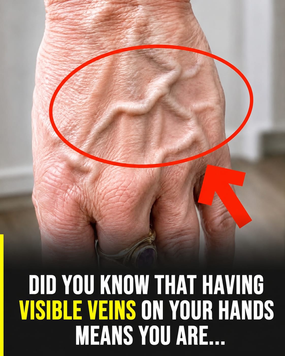 Did you know that having visible veins means you are… See more