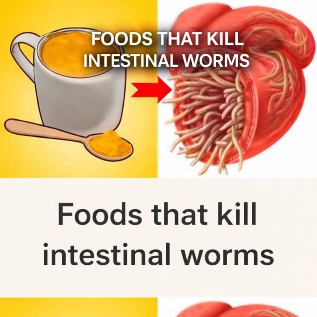 7 Foods That Kill Intestinal Worms