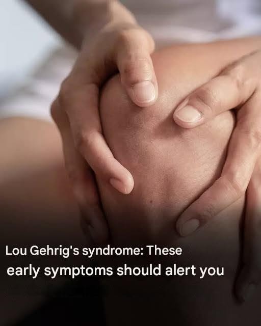 Lou Gehrig’s syndrome: Here are the first symptoms of this disease