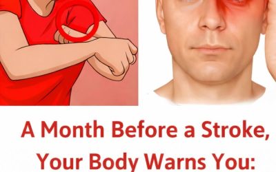 A Month Before a Stroke, Your Body Warns You: 10 Signs Not to Ignore