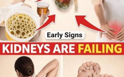 Your Kidneys Are SCREAMING! 5 Sneaky Signs You CANNOT Ignore (Before Dialysis Takes Over Your Life)