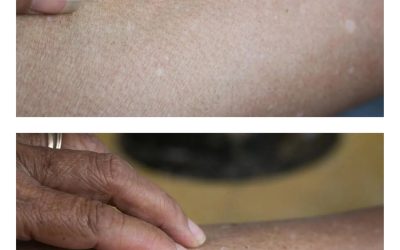 These are the first symptoms of a… See more