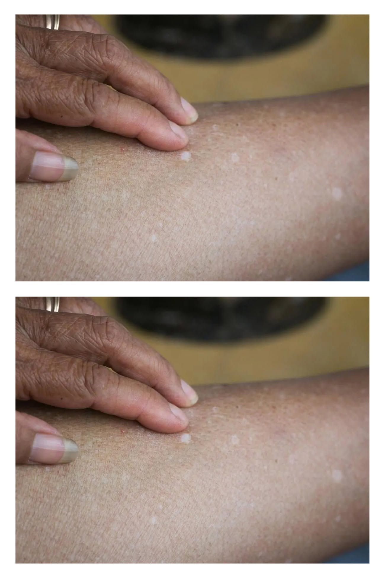 These are the first symptoms of a… See more