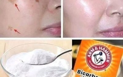 4 Ways to Erase Age Spots with Baking Soda for Younger, More Even Skin