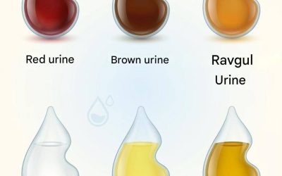 What does the color of your urine say about your health?